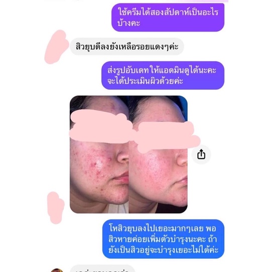 กันแดดสิว-สินค้าขายดี-dr-somsak-clinic-ครีมหมอสมศักดิ์-ดีจริง-ไม่ต้องลองมั่งให้หน้าพัง