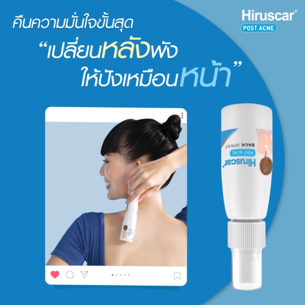 พร้อมส่ง-hiruscar-post-acne-back-spray-50ml-รู้สึกถึงผลลัพธ์ได้ใน-7-วัน-สเปรย์บำรุงผิวกาย-จากฮีรูสการ์