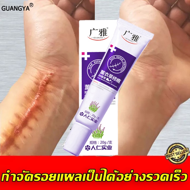 จัดส่งสินค้าจากไทย-ครีมลดรอยแผลเป็น-ครีมรักษาแผลเป็น-ครีมลดแผลเป็น-ลบรอยแผลเป็น-แผลเป็น-รักษารอยแผลเป็น-ครีมแผลเป็น