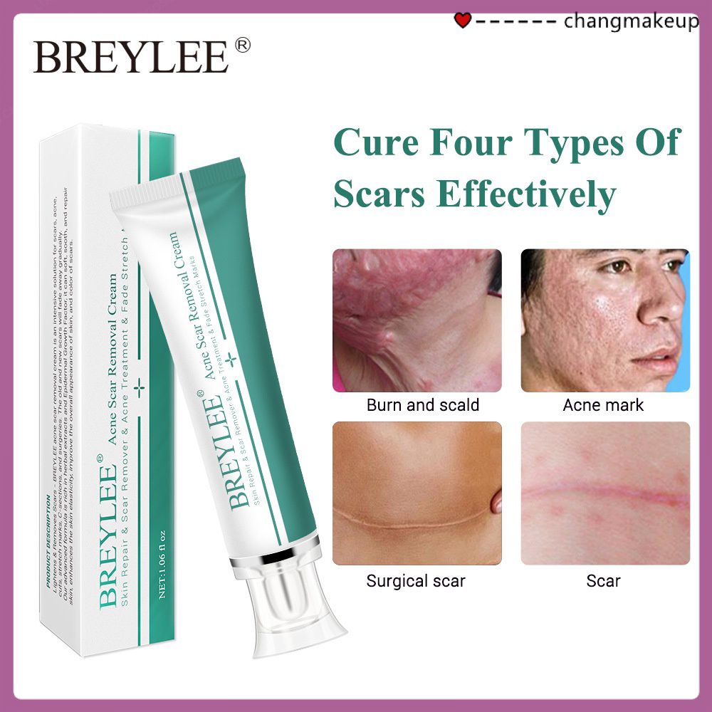 breylee-scar-removal-gel-30g-ครีมลดรอยแผลเป็น-ลดผิวแตกลาย-ลบรอยแผลเป็น-ลดเลือนป้องกันรอยแผลเป็น-cod