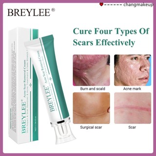 BREYLEE Scar Removal Gel 30g ครีมลดรอยแผลเป็น ลดผิวแตกลาย ลบรอยแผลเป็น ลดเลือนป้องกันรอยแผลเป็น Cod