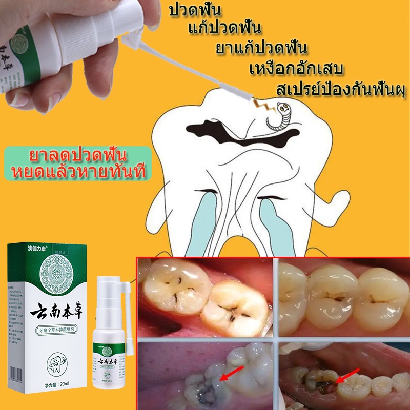 สั่งซื้อ ยาแก้ปวดฟัน เหงือกบวม ในราคาสุดคุ้ม | Shopee Thailand