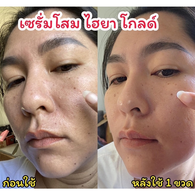 พร้อมส่ง-ส่งฟรี-เซรั่มโสมทองไฮยา-ginseng-hya-เซรั่มหน้าใส-สูตรเข้มข้น-ลดสิว-ฝ้า-กระ-ริ้วรอย-กระชับ-ขนาด-30-ml