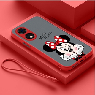 [ฟรีสายคล้อง] Oppo Reno 8T 8Z 8 Pro 5G reno8T 5G มินนี่เมาส์ ปุ่มตัดกัน เคลือบด้าน พลาสติกใส เคสโทรศัพท์ นิ่ม กันชน