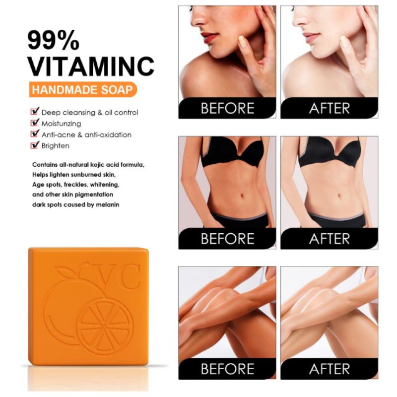 ส่งไว-ส่งถูก-สบู่-สบู่วิตามินซี-สบู่ส้ม-สบู่อาบน้ำ-vitamin-c-soap
