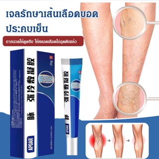 [ซื้อ 1 ฟรี 1] เจลรักษาเส้นเลือดขอดประคบเย็น 20g