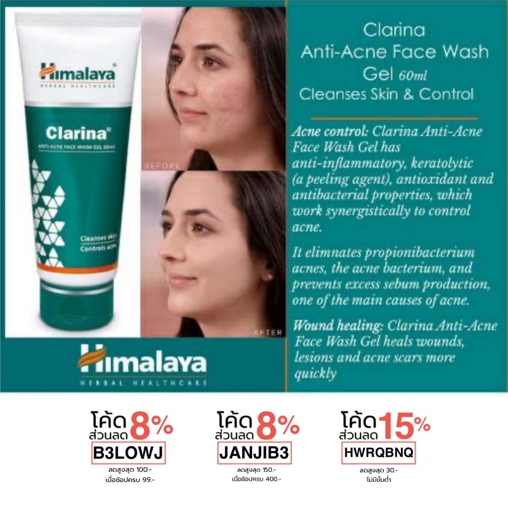 เจลล้างหน้าลดสิวอักเสบ สูตรเข้มข้น Himalaya Clarina AntiAcne Face Wash