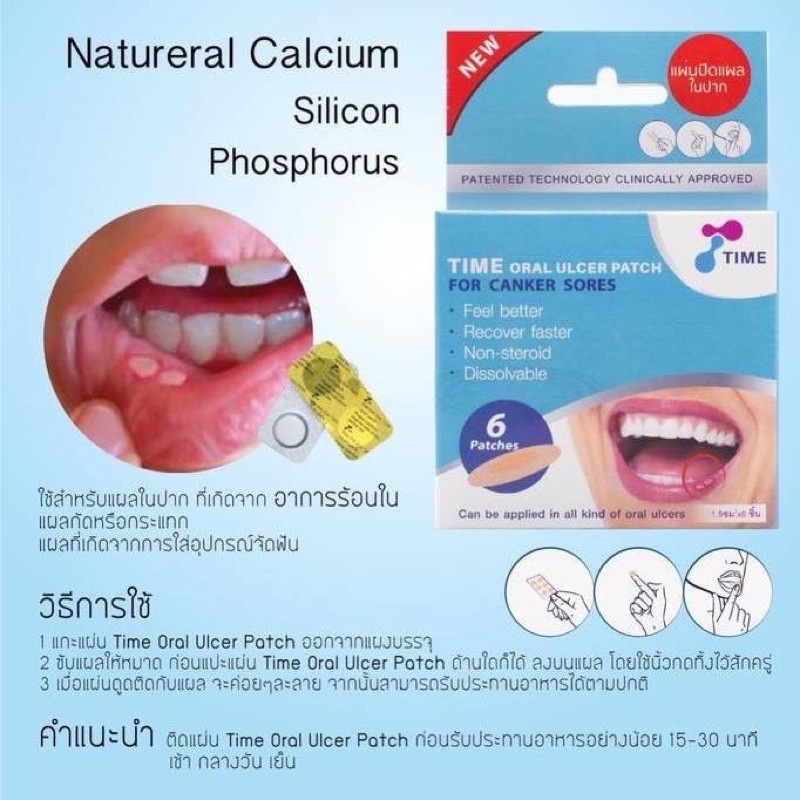 แผ่นแปะร้อนใน-แผ่นแปะแผลในปาก-แผลร้อนใน-time-oral-ulcer-patch-กล่อง-6-ชิ้น