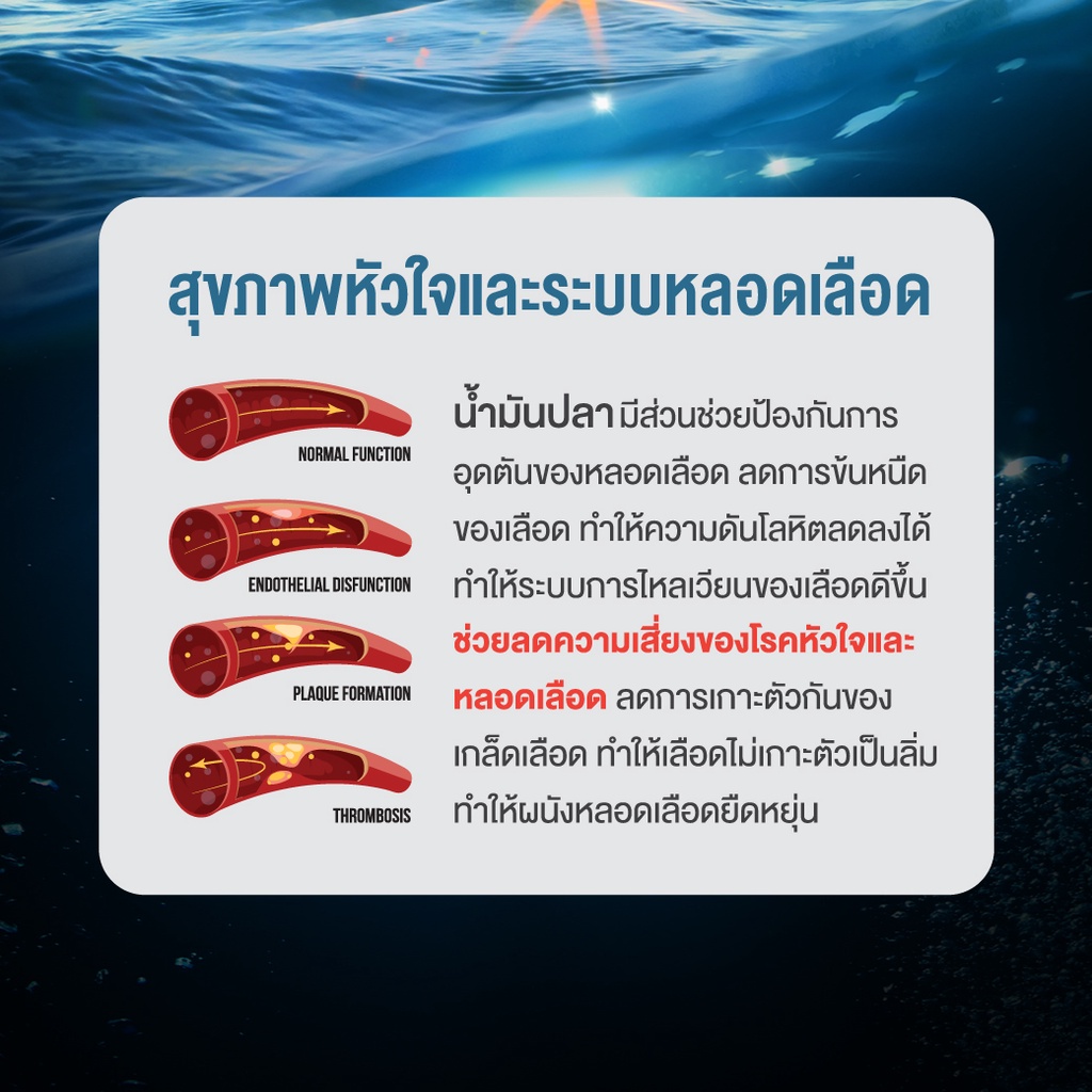 น้ำมันปลา-fish-oil-ฟิชออย-สุขภาพสมองและความจำ-ช่วยบำรุงสายตา-และ-ความจำ-ze-mega3-ขนาด-30-เม็ด