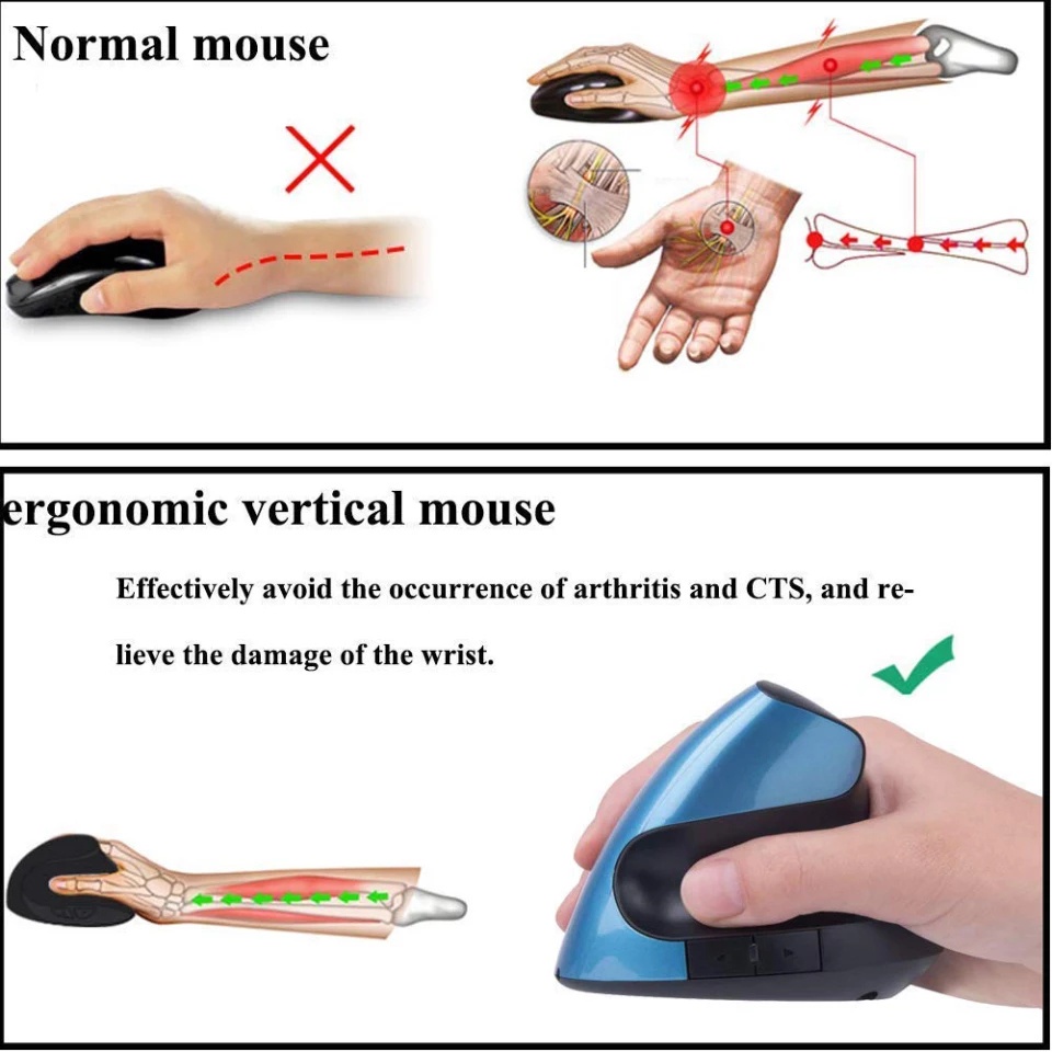 เมาส์ในแนวตั้ง-เพื่อสุขภาพมือ-2-4g-wireless-แนวตั้งป้องกันนิ้วล็อค-เพื่อสุขภาพมือ-จากการใช้คอมนานนาน