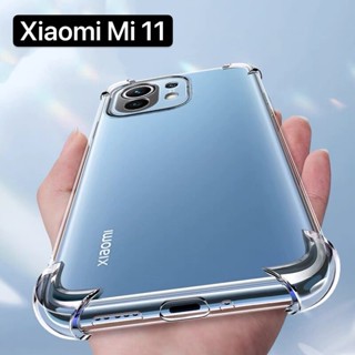 ส่งจากไทย Case Xiaomi Mi 11 เคสโทรศัพท์ เคสใส เคสกันกระแทก case xiaomi mi11 เคสนิ่ม ของแท้ กันกระแทก เคสมือถือ