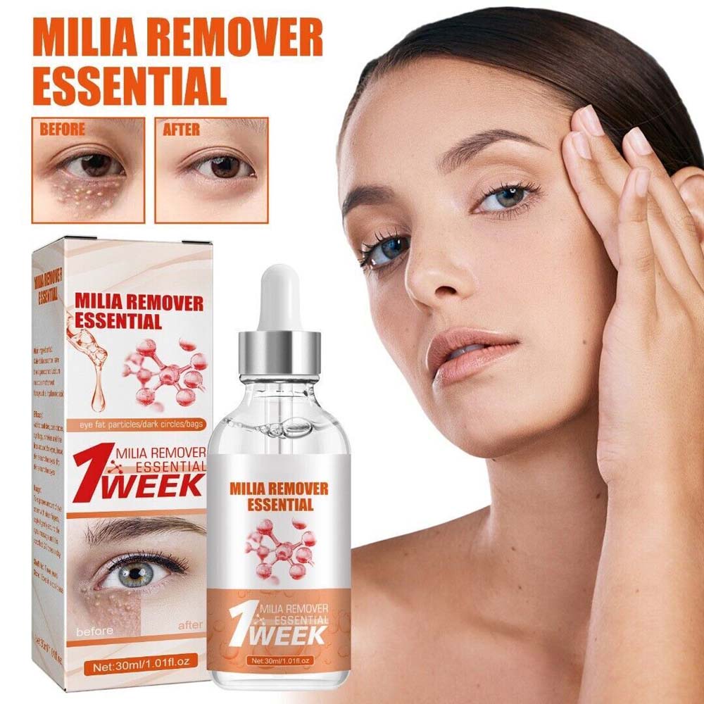 south-moon-fat-free-eye-essence-softens-cleans-stains-moisturizes-eyes-removes-edema-30ml-box