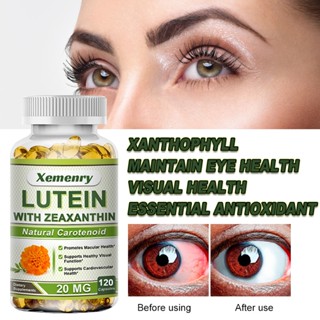 XEMENRY Lutein 20mg การบรรเทาความเครียดของดวงตา, ​​การป้องกันแสงสีฟ้า, การป้องกันสุขภาพของจอประสาทตาและการมองเห็น