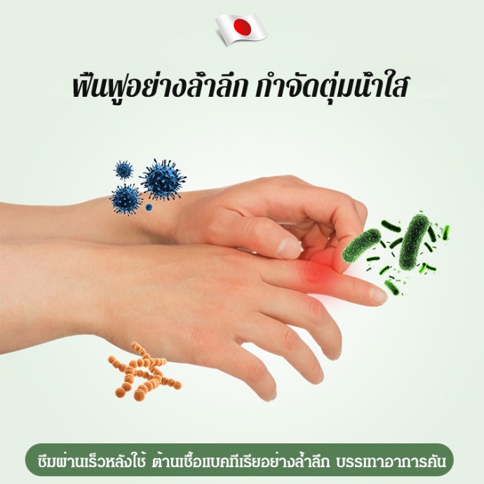 รักษาให้หายขาด-ยาทารักษากลาก-เกลื้อน-ลดอาการผิวอักเสบ