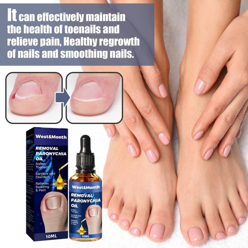 blueoutlet-removal-paronychia-oil-น้ำมันฆ่าเชื้อราที่เล็บลดปวดบวมอักเสบ