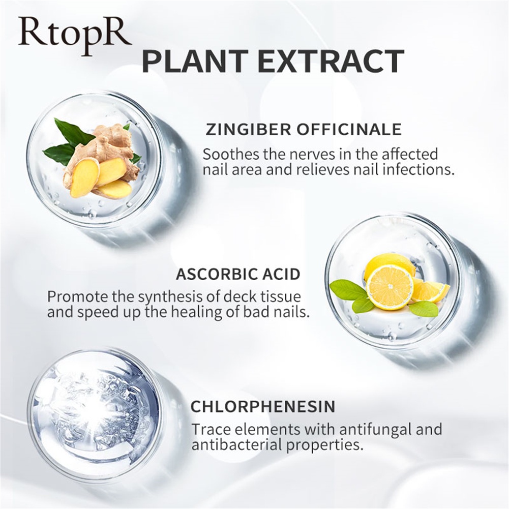 Rtopr Ginger ยาทาเล็บต้านเชื้อแบคทีเรีย Onychomycosis Paronychia Anti ...