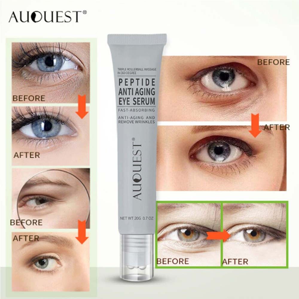 20g-auquest-eye-essence-cream-with-massage-stick-polypeptide-eye-cream-eye-retinol-essence-to-eliminate-edema