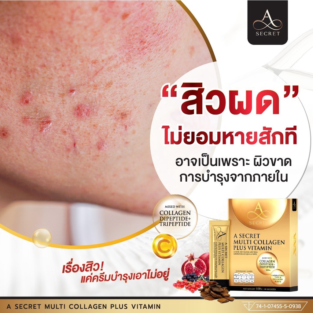 ของแท้-เอคอลลาเจน-คอลลาเจนพี่เอ-ศุภชัย-ผิวลื่น-เนียนใส-คงความอ่อนเยาว์-แคลอรี่เพียง-35-เห็นผลภายใน-1-กล่อง-พร้อมส่ง