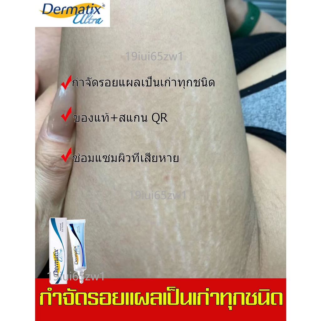 ของแท้-100-dermatix-ultra-gel-นำเข้า-usa-ยาทาแผลเป็นนูน-ซ่อมแซมผิวที่เสียหาย-ลดรอยแผลเป็น-รักษาแผลเป็น-เดอร์มาติกซ์-อ