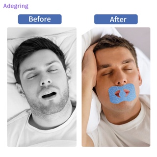 [Adegring] สติกเกอร์เทปปิดปาก ป้องกันการนอนกรน สําหรับเด็ก 20 ชิ้น ต่อถุง