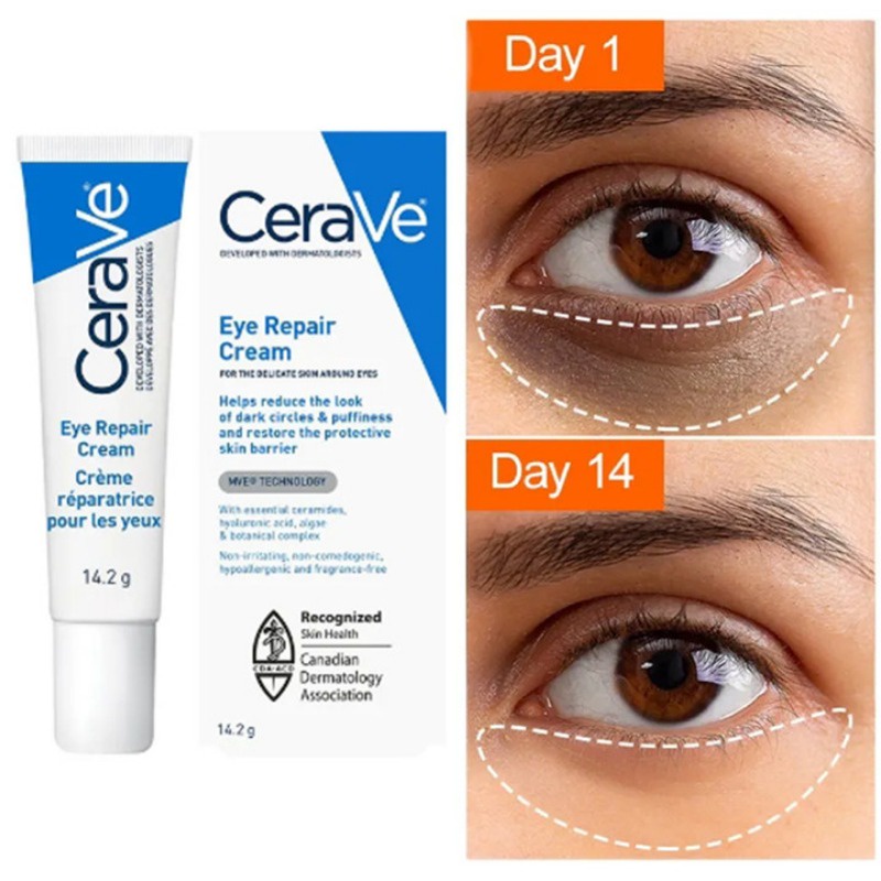julystar-cerave-eye-repair-cream-สำหรับรอยคล้ำใต้ตาและอาการบวม