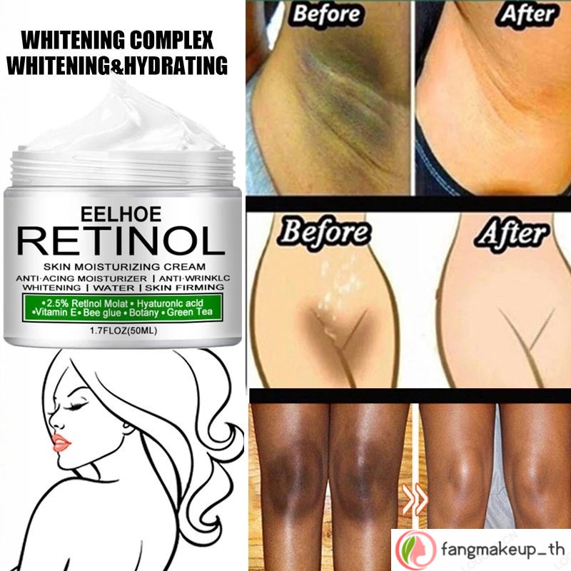 eelhoe-retinol-ครีมไวท์เทนนิ่ง-ฟอกสีร่างกาย-ใต้วงแขน-ขา-เข่า-ไวท์เทนนิ่งครีม-ฟอกสีหน้า-ร่างกาย-ลดใต้วงแขน-รักแร้-ขา-เข่า-50-มล