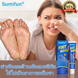 {ของแท้100%}Sumifun ครีมระงับกลิ่นเท้า ที่มีประสิทธิภาพ100% ครีมรักษาเชื้อราที่เท้า  ถอดเท้าของนักกีฬา การดูแลเท้า