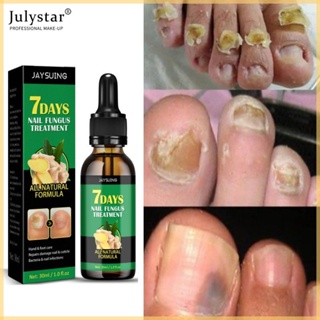 JULYSTAR Jaysuing 7วัน Nail Fungus Treatment Essence Serum Nail Repair Care Hand And Foot Care Anti-Injective Anti-Bacterial Serum Onychomycosis Paronychia Anti-Fungal Nail Infection