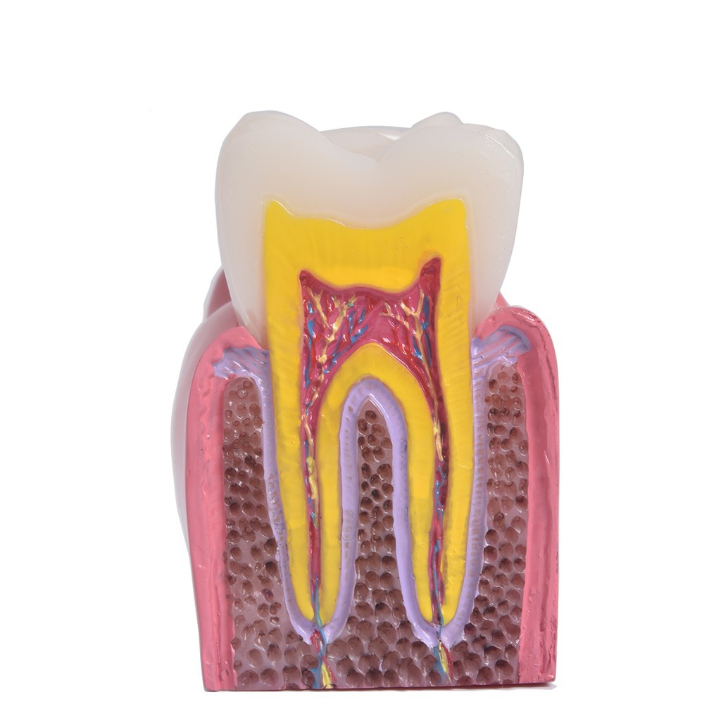 เครื่องมือทันตกรรม-decay-ฟันเปรียบเทียบโมเดลการศึกษา-6-เท่า-caries-เครื่องมือการสอนฟัน