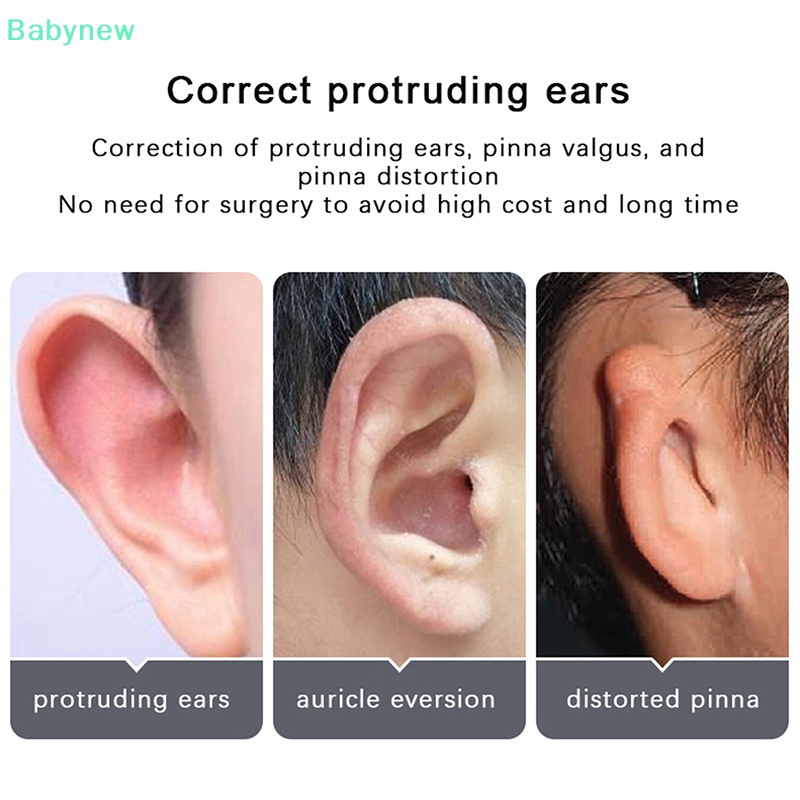 lt-babynew-gt-สติกเกอร์ติดหู-ขนาดเล็ก-พกพาง่าย-ไม่ต้องผ่าตัด-ไม่มีหูใหญ่-1-3-ชิ้น