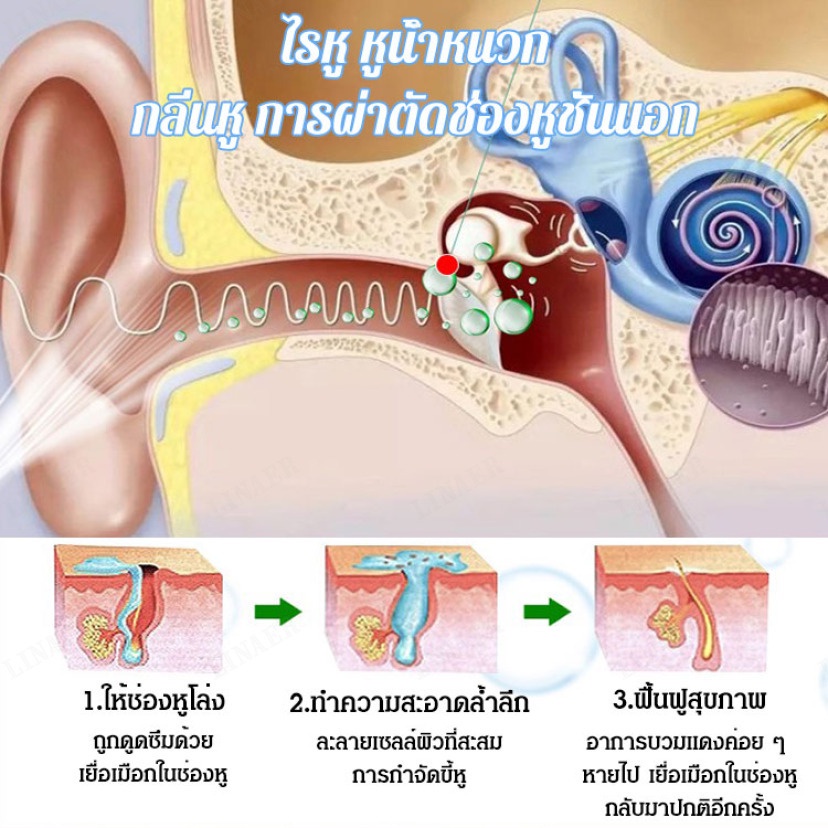 น้ำยาล้างหู-yiyanshu-ซื้อมากแถมมาก