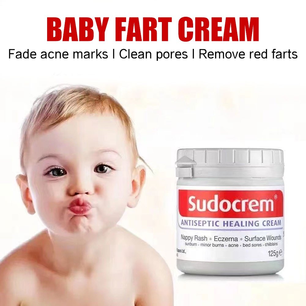 พร้อมส่ง-sudocrem-ของแท้-100-sudocream-ซูโดเครม-ซูโดครีม-ครีมทาก้นเด็ก-125-g