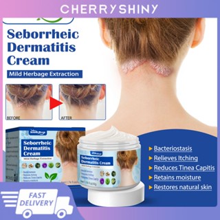 ใหม่ Seborrheic ครีมบํารุงผิว Ac-ne Pruritus ครีมซ่อมแซมหนังศีรษะ หนอน