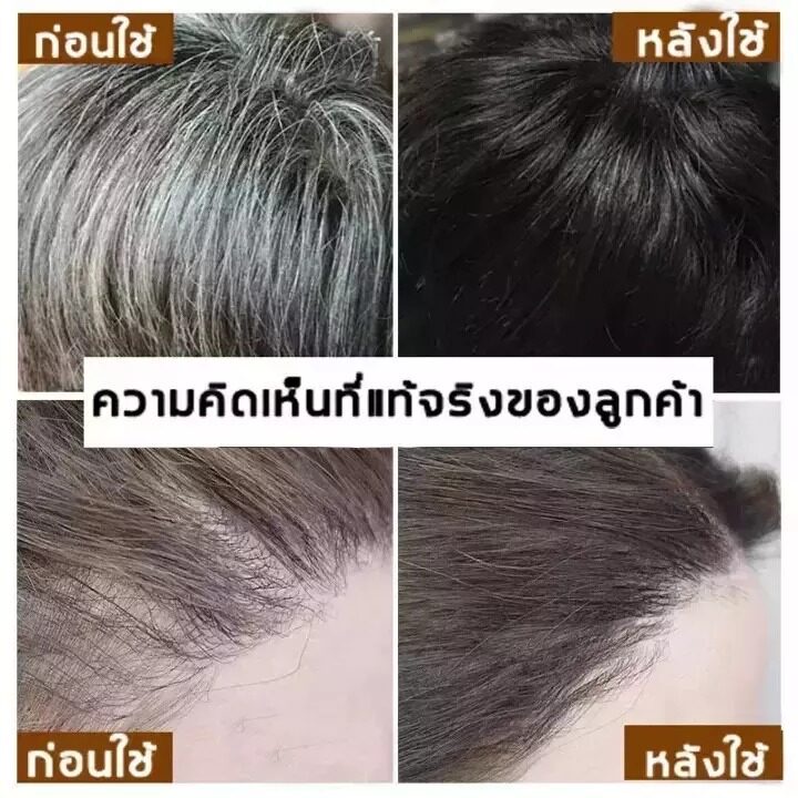 soith-moon-100ml-ผมขาวเปลี่ยนเป็นผมดำ-นำ้ยาปิดผมหงอก-เซรั่มลดผมหงอก-แก้ผมหงอก-น้ำยาแก้ผมหงอก-ผมหงอกกลับมาดำ-แก้ผมหงอกถาว