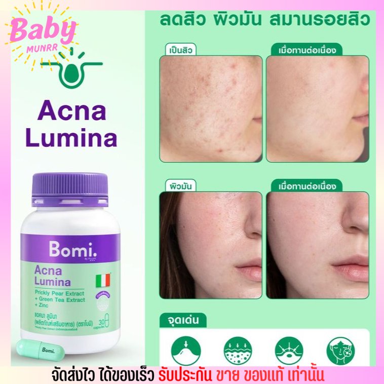 ขายดี-bomi-acna-lumina-30-capsules-สูตรลดสิว-ลดความมัน-ลดโอกาสเกิดสิวใหม่-โบมิ-แอคเน่