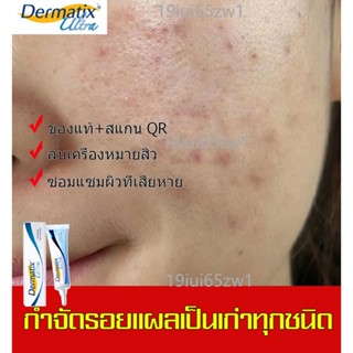 ผลิตภัณฑ์บำรุงผิวหน้า ️แท้ พร้อมส่ง ️Dermatix Ultra Gel 15g ครีมลบแผลเป็น  เดอร์มาติกซ์ อัลตร้า เจล ครีมลดรอยแผลเป็น