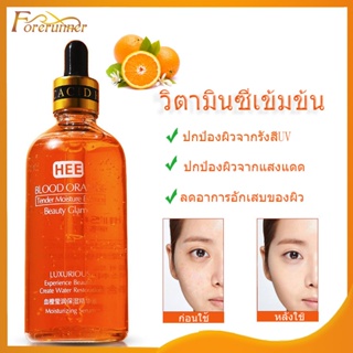 เซรั่มส้ม เซรั่มส้มสีเลือด Hydration Blood Orange Essence100ml เซรั่มรักษาฝ้ากระ จุดด่างดำ  เพื่อผิวกระจ่างใส（097）