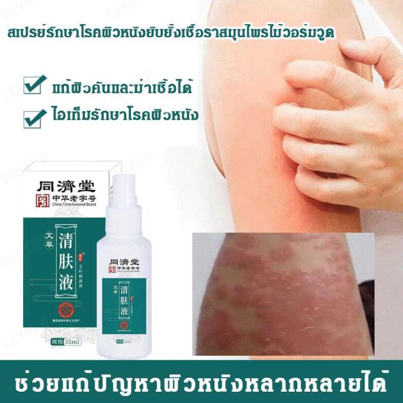 1-2pcs-สเปรย์รักษาโรคผิวหนังยับยั้งเชื้อรา-บรรเทาอาการคันผิวหนังและผื่นแดง