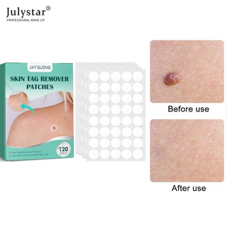 JULYSTAR 120pcs Skin Tag Remover Patches ไฮโดรคอลลอยด์ Corn Moles แผ่นกำจัดหูด