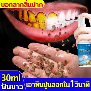 เอาหินปูนออกใน น้ำยากำจัดหินปูน 30ML ขจัดคราบหินปูน ยาสีฟันฟอกฟันขาว กําจัดนิ่วในฟัน ยาสีฟันฟันขาว ซ่อมฟันเหลือง ฟันขาวข