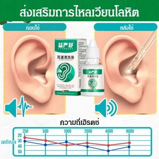 น้ำยาล้างหู YIYANSHU [ซื้อมากแถมมาก]