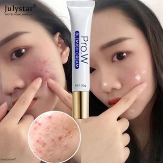 JULYSTAR Pro.w ครีมฝ้ากระ/สิวสิวแผลเป็น/สิวแผลเป็น/จุดด่างดำกำจัดผิว/ไวท์เทนนิ่งสดใสใบหน้าครีม