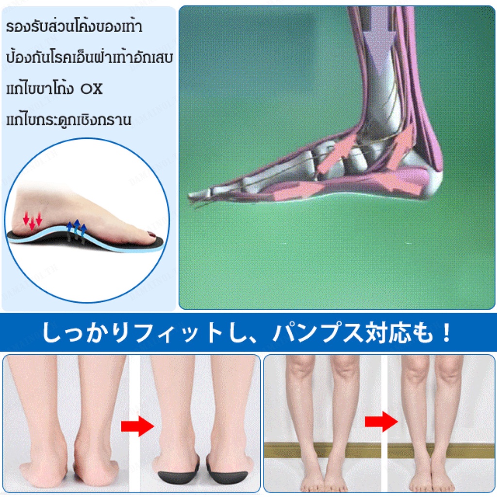 valgus-xo-แผ่นพื้นรองเท้า-ส้นแบน-สําหรับแก้ไขขา