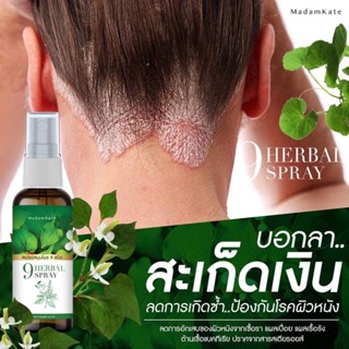 ส่งฟรี ✅ ของแท้ ✅ สเปรย์สมุนไพร สำหรับโรคผิวหนัง สะเก็ดเงิน สะเก็ดทอง กลากเกลื้อน เชื้อรา แก้อักเสบ ผื่นแพ้ คันลมพิษ