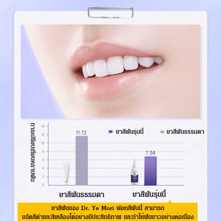 ยาสีฟันไวท์เทนนิ่งทำให้ฟันขาวขึ้น-ลมหายใจสดชื่น-ปกป้องเหงือก-ยาสีฟัน