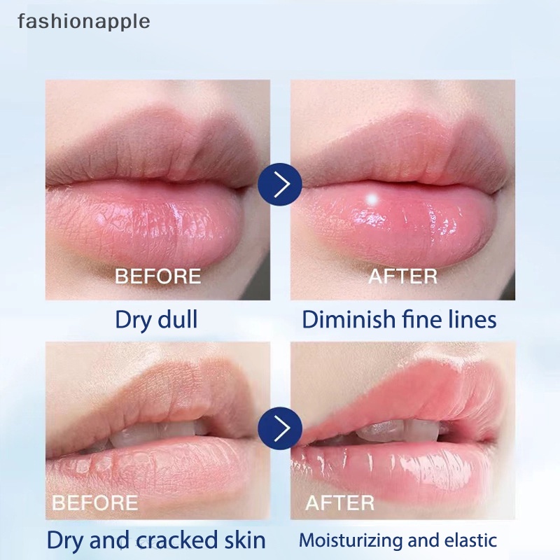vaseline-fashionapple-ลิปบาล์มวาสลีน-ให้ความชุ่มชื้น-ป้องกันการแตกร้าว-และซ่อมแซมริมฝีปาก