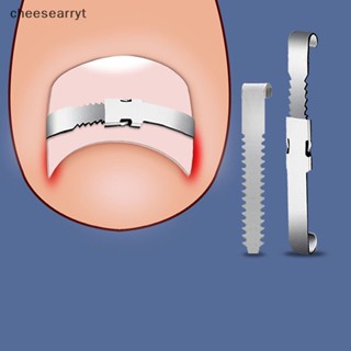อุปกรณ์ดูแลเล็บเท้า เล็บขบ เล็บเท้า EN