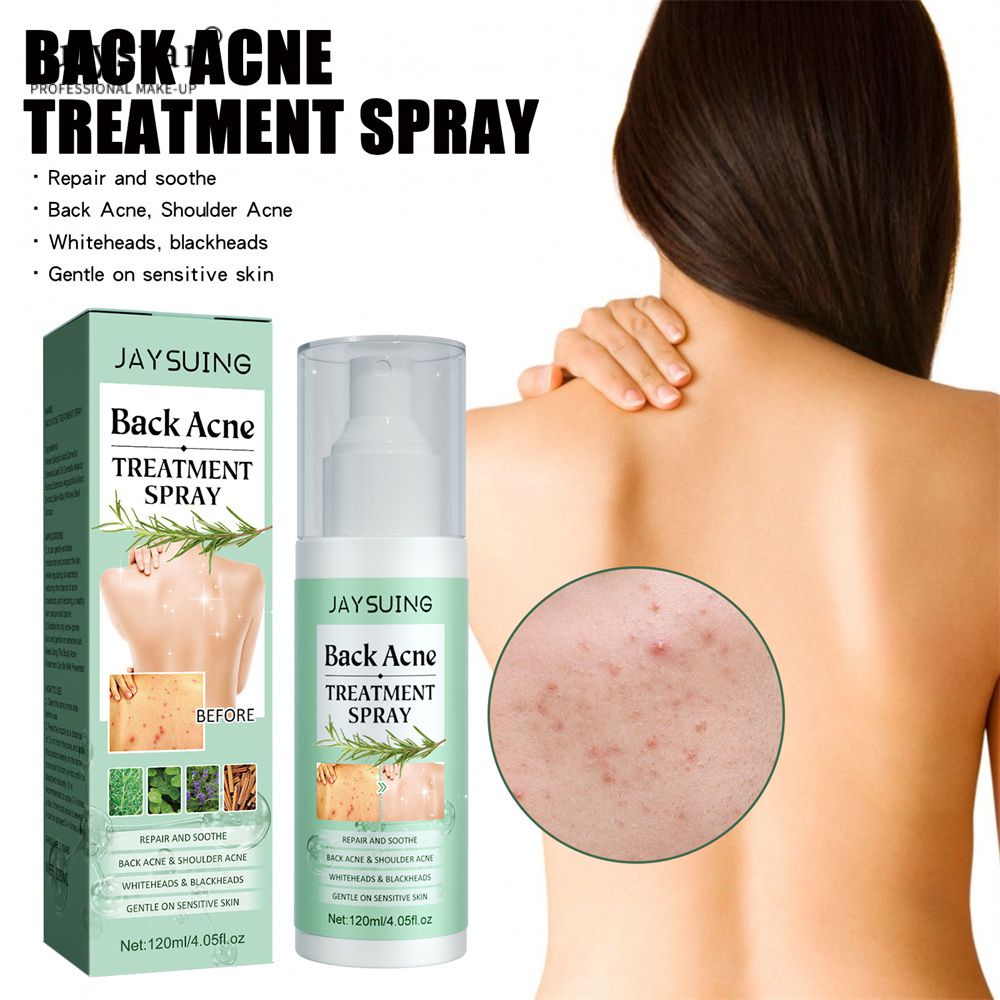 julystar-back-acne-treatment-spray-repairs-back-and-shoulder-acne-lightens-acne-scars-skin-care-spray-120ml-สเปรย์รักษาสิวที่หลัง