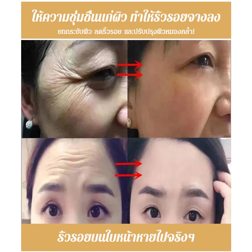 เซตน้ำตบหน้าแบบลดริ้วรอย-ให้ผิวเนียนเรียบเนียน-ด้วยเทคโนโลยีนาโนชุ่มชื่นที่สามารถละลายได้เร็ว