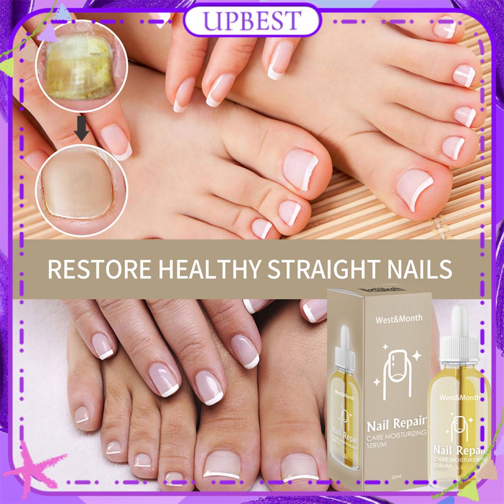 West&month Nail Repair Care Moisturizing Serum Anti Fungul Relieve Itching Burning Scaling